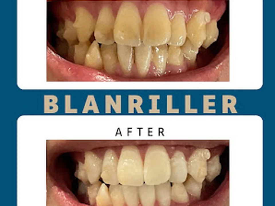 blanriller天王寺阿倍野店